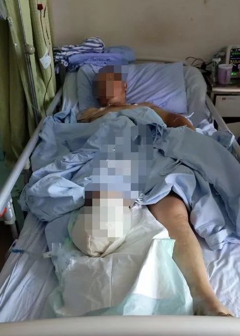 逆境重生，腿被绞断后的挣扎与希望
