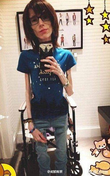 女子减肥上瘾身高一米六体重仅五十二斤，极端追求瘦身的背后故事