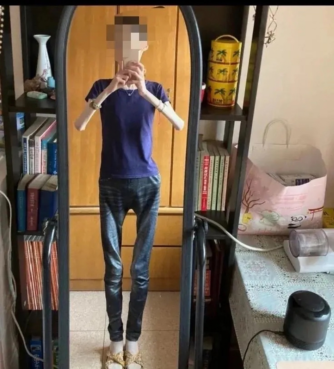 女子减肥上瘾身高一米六体重仅五十二斤，极端追求瘦身的背后故事
