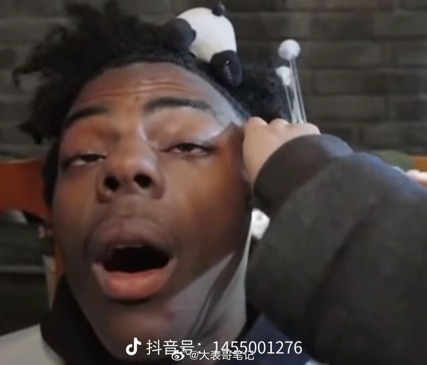 甲亢哥遭遇重庆卤鹅，表情包的诞生