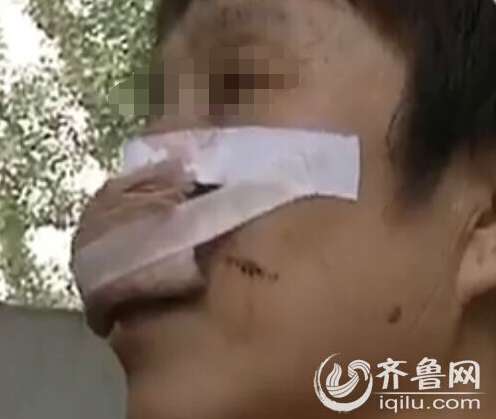 被咬掉舌头的主播，逆境中的重生