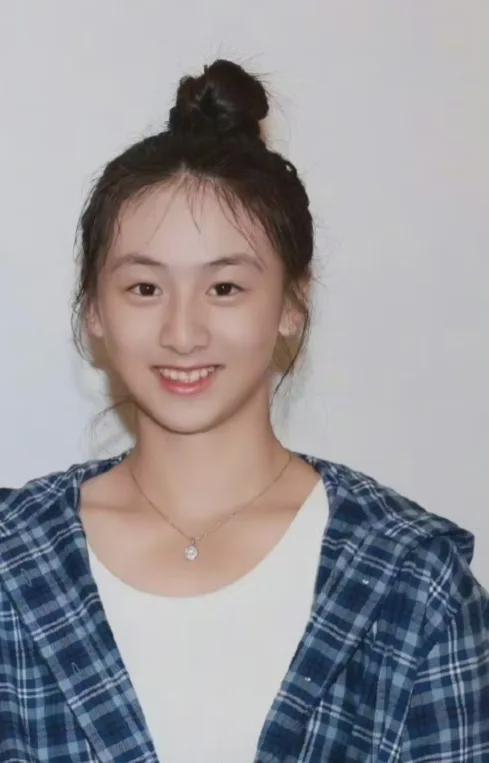 森碟下巴后缩改善之路，见证奇迹的蜕变之旅