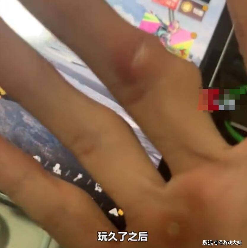 多位捏捏玩家遭遇喉咙痛与烂手指，游戏健康隐患引关注