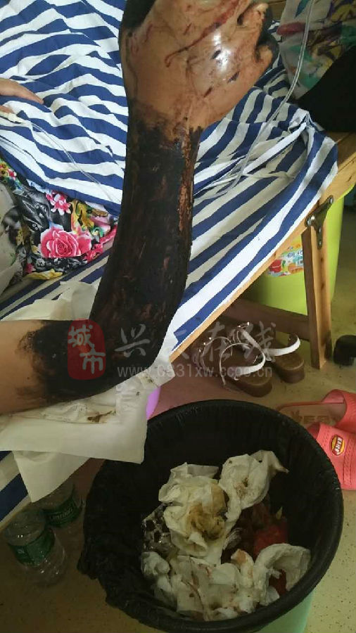 女子疑被蛇咬身亡，事件深度解析与回应预计