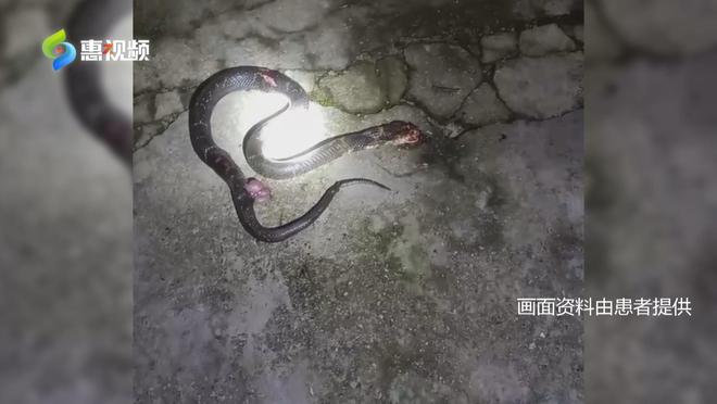 被蛇咬后二十年会复发不，深度解析与科学解读