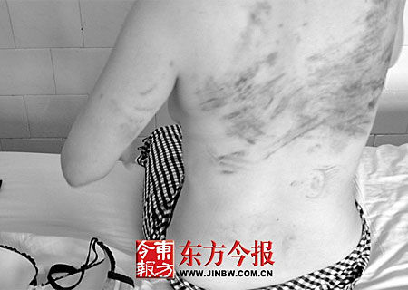 女子拍了下老公后背，手掌印清晰可见