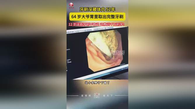 大爷体内惊现藏身52年的牙刷秘闻